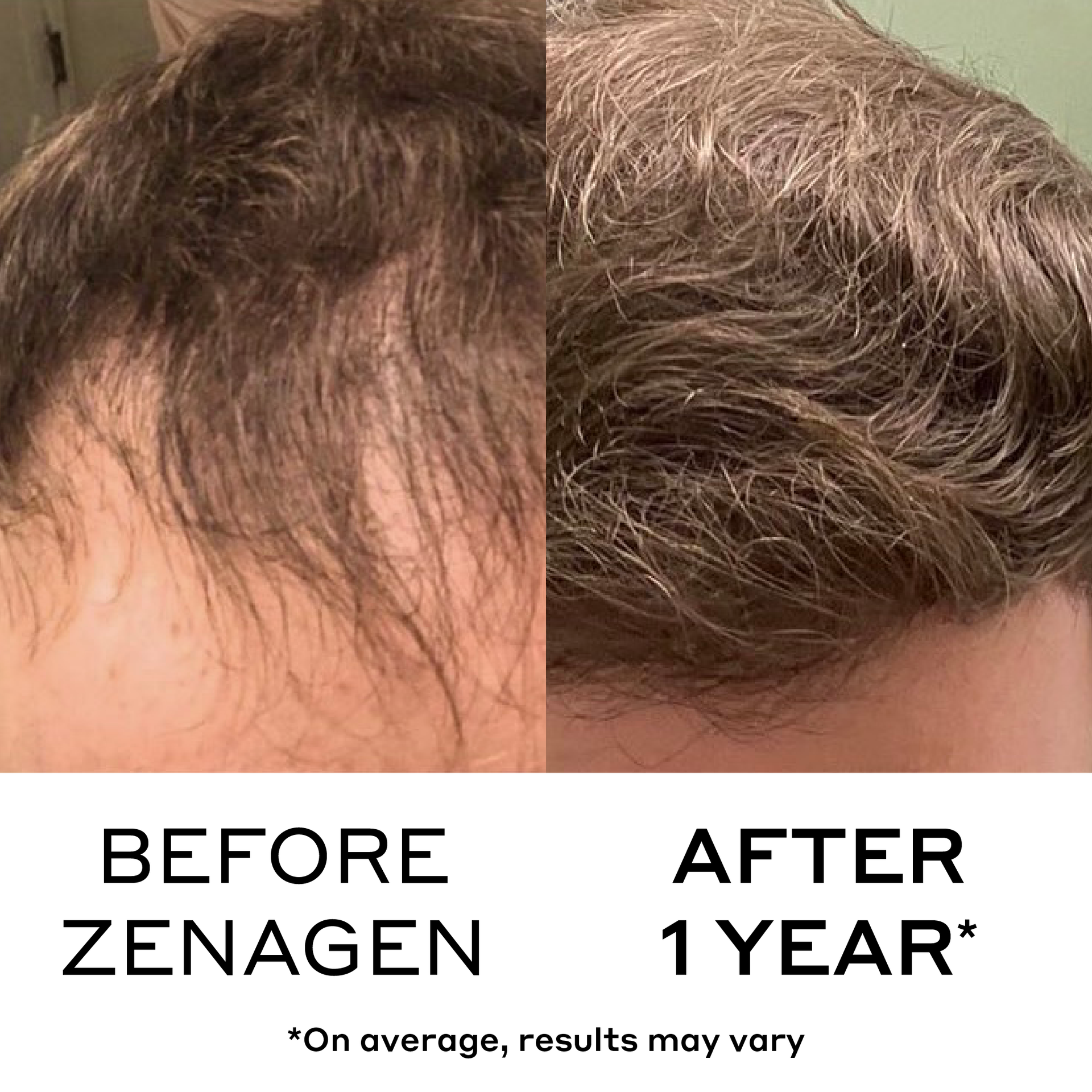 Zenagen Revolve Men's Travel Kit
